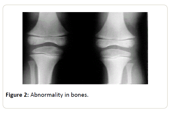skin-diseases-skin-care-Abnormality-bones