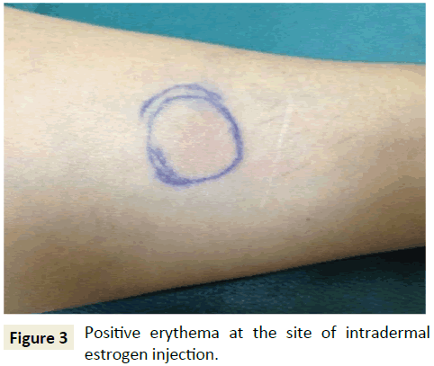 skin-diseases-skin-care-Positive-erythema-site