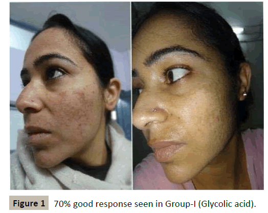 skin-diseases-skin-care-good-response